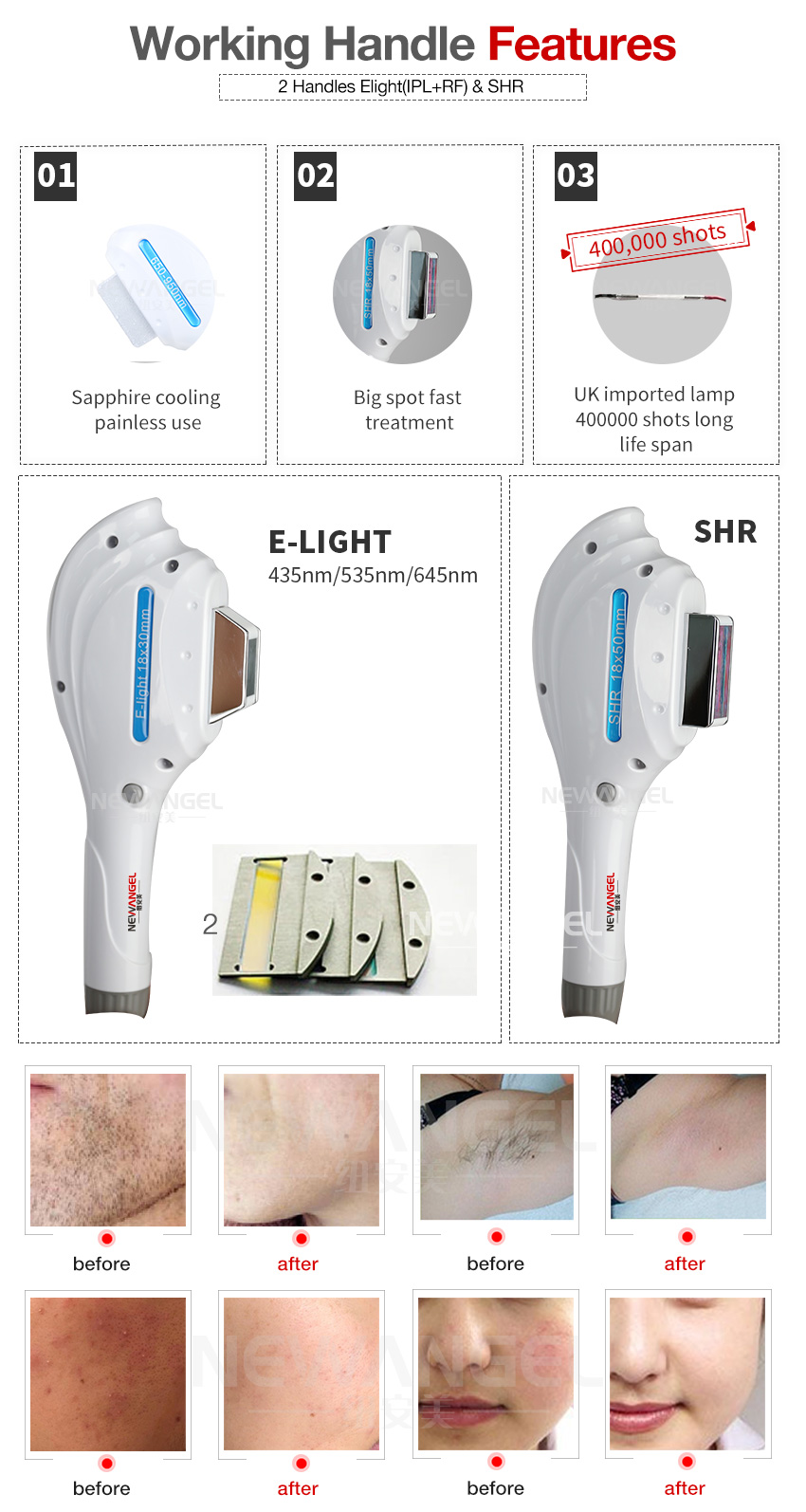 Ipl bikini line hair removal machine for beauty salon use