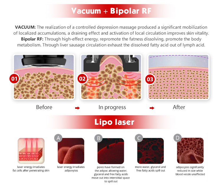 Ultrasonic Radio Frequency Laser Fat Removal Machine from China Manufacturer Beauty machine