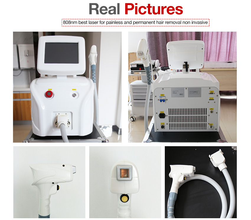 CE approved laser hair removal machines for sale australia