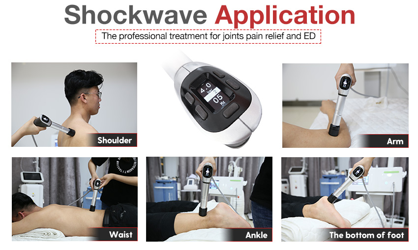 Leg Knee Pain Relief Focused Shock Wave Therapy Ed